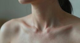 betrayal stress causes neck pain